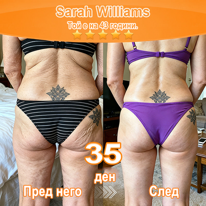 Purelora® Ревитализиращ есенциален крем с екстракт от стволови клетки, EGF и медни пептиди