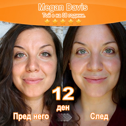 Purelora® Ревитализиращ есенциален крем с екстракт от стволови клетки, EGF и медни пептиди